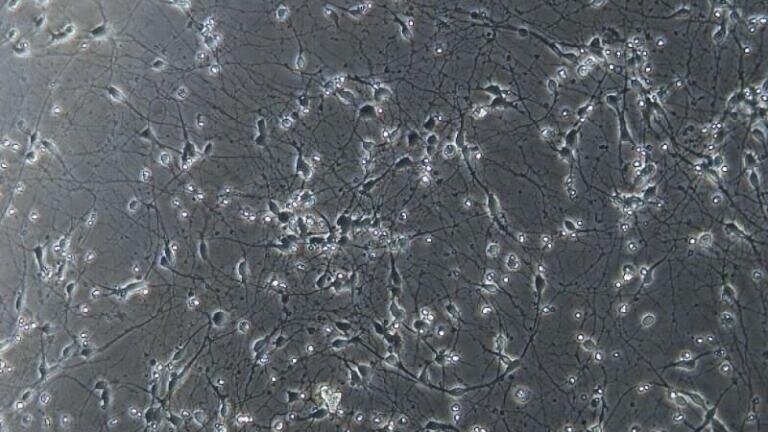 Motor neurons grown from iPS cells in the lab, viewed down a microscope. Credit: Jasmine Harley